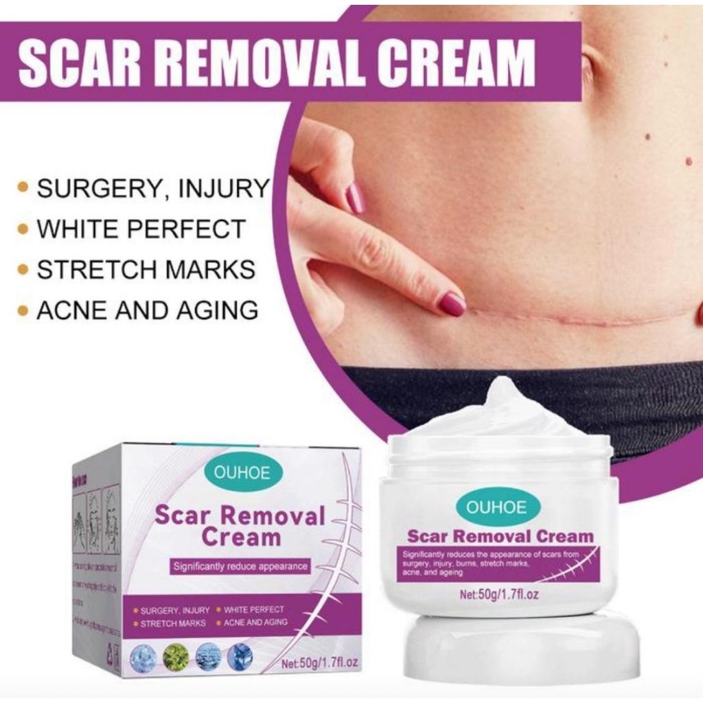 Cream Penghilang Bekas Luka OUHOE / Scar Removal Cream / Krim Penghilang Bekas Luka OUHOE