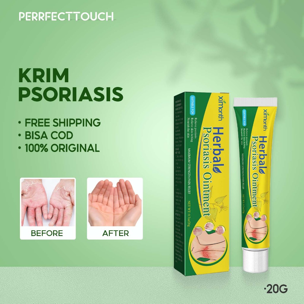 Ximonth Krim Psoriasis 20g Salep Redakan Gatal Kulit Meredakan Kulit Merah, Gatal, Dan Mengelupas Pa