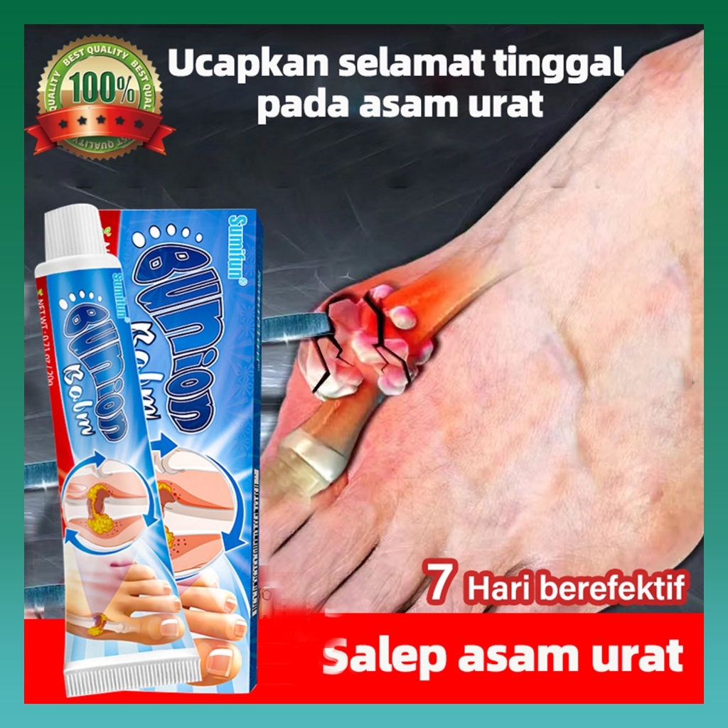 Salep nyeri sendi asam urat, obat asam urat, salep artritis, obat nyeri sendi rematik