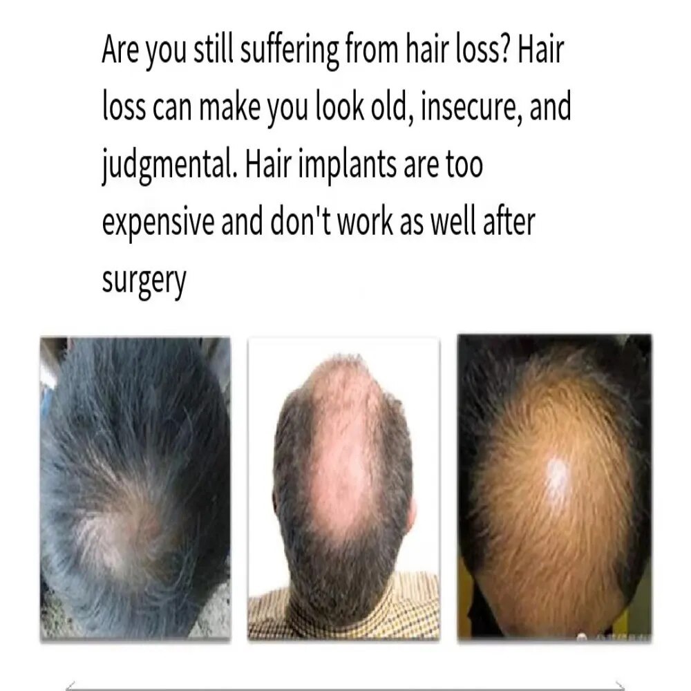 Wig Pria Pendek Rambut Asli Tampan Inci Penuh Rambut Rambut Asli Pria