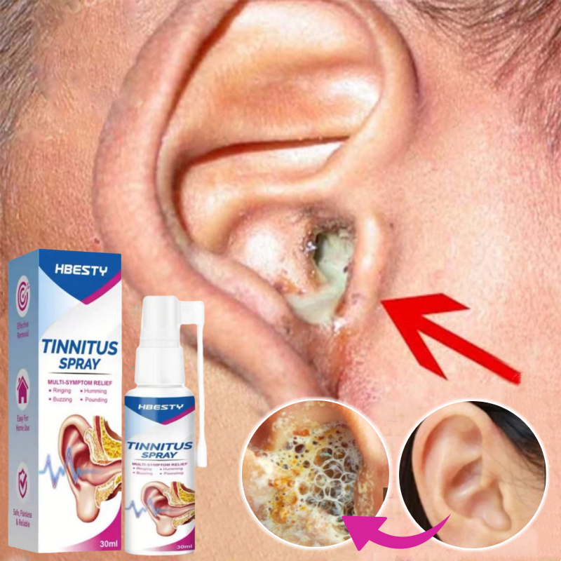 Obat Tetes Telinga Pembersih Telinga Obat Penyumbat Telinga Semprotan Tinnitus Pengobatan Sakit Teli