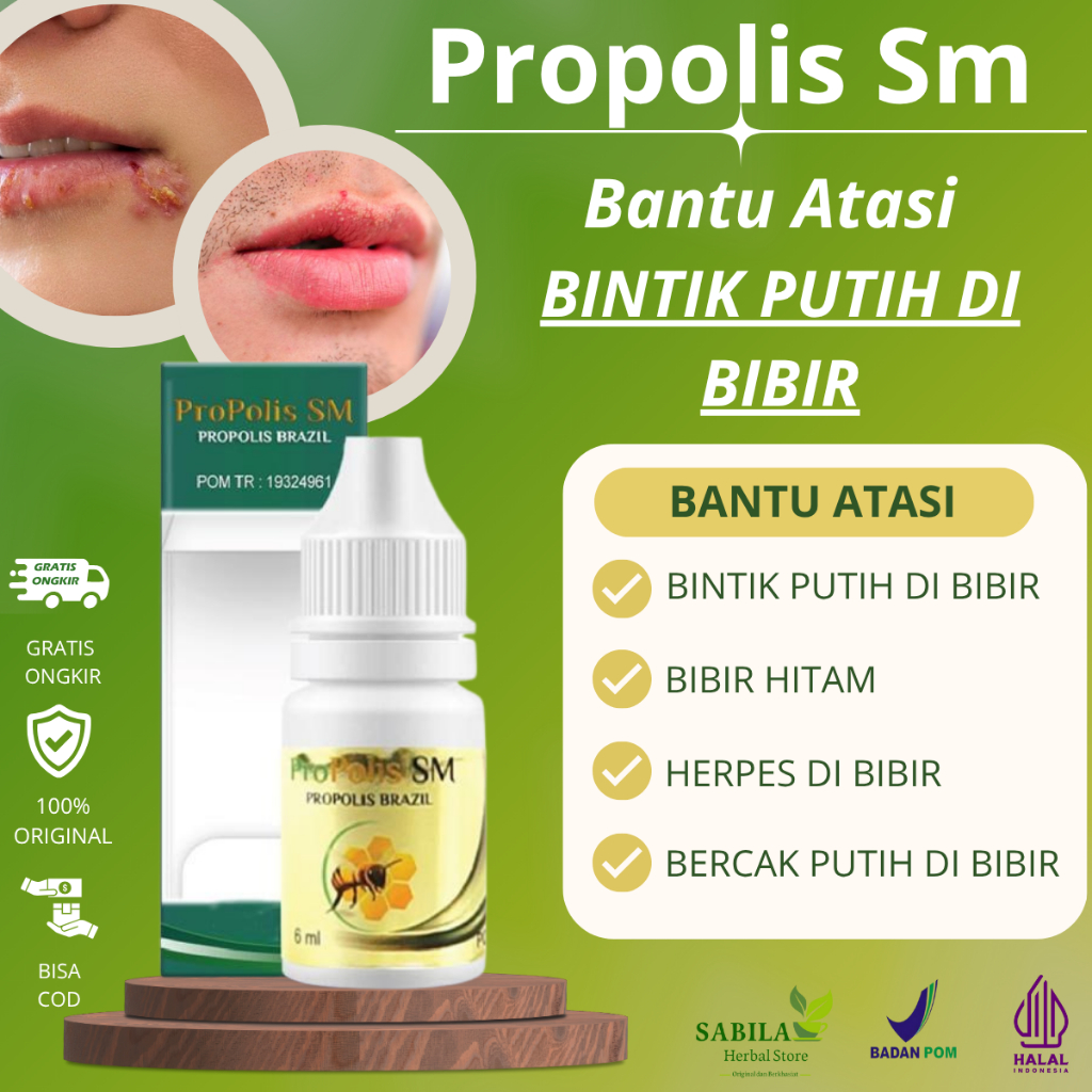 Perawatan Bintik Putih Di Bibir, Penghilang Bintik Putih Di Bibir / Forduce Spots, Herpes Bibir, Bib