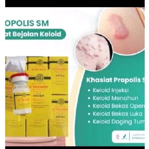 

Ready!! Ampuh dan murah tutup merah Untuk kulit