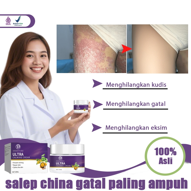 Salap gatal china obat gatal selangkangan dan hitam salep kulit 20g Salep selangkangan gatal dan lec