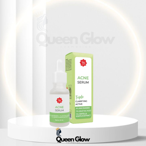 (3PCS) Viva Acne Serum – Serum Jerawat untuk Kulit Berjerawat & Berminyak