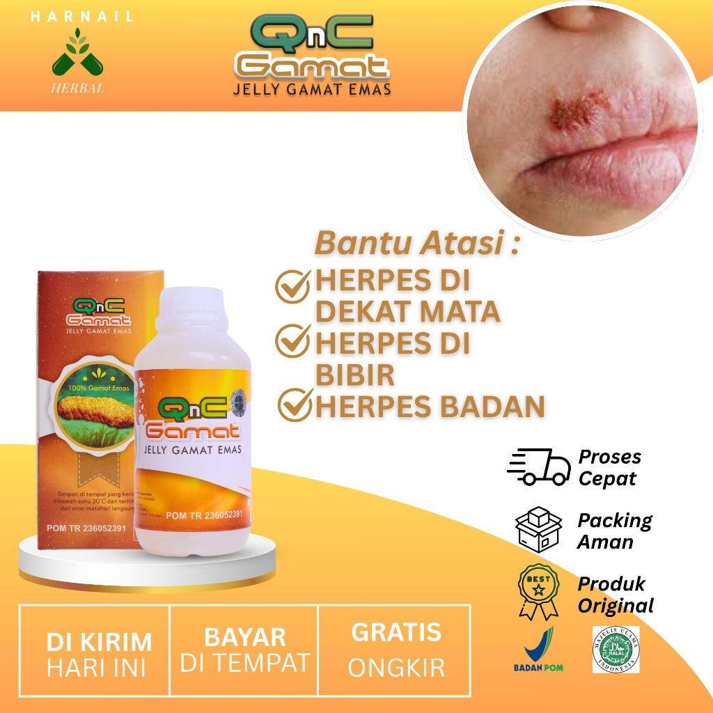 Qnc Jelly Gamat Emas Obat Untuk Herpes Di Dekat Mata Herpes Di Bibir Herpes Badan