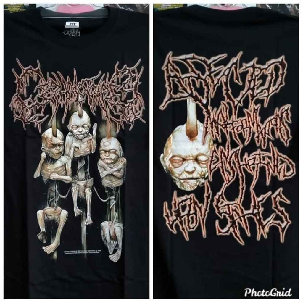 Ts cephalotripsy - bisected