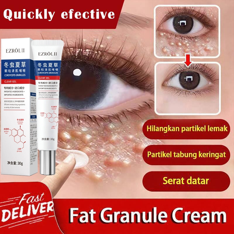 Pelembab tubuh melembabkan Krim mata Krim Penghilang Milia Cream penghilang milia bintik lemak fat g