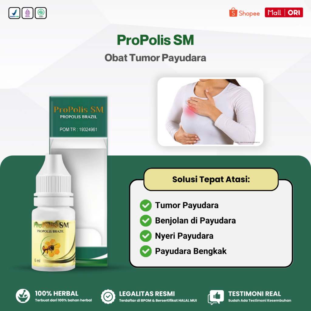 Obat Tumor Payudara, Penghancur Benjolan Tumor Payudara Jinak FAM Kista Fibroadenoma, Propolis SM