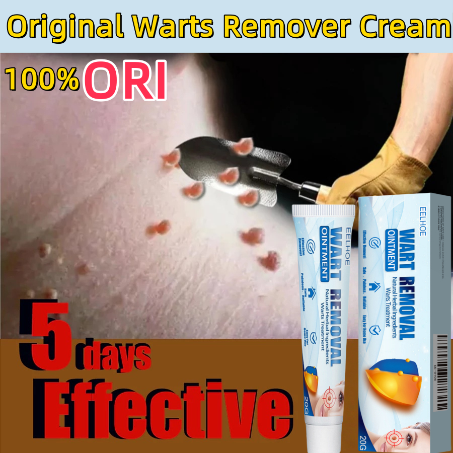 100% ORI Penghilang Kutil Dan Tahi Llat Wart Removal Cream Krim Penghilang Kutil Di Wajah Obat Kutil