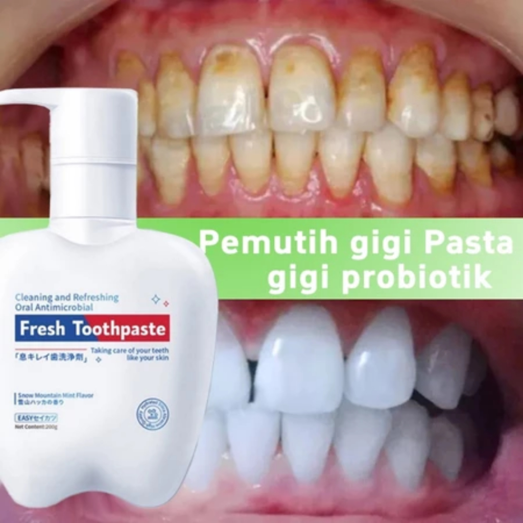 Pembersih Karang Gigi Pemutih Gigi Odol Perontok Karang Gigi Pasta Gigi Pembersih Karang Gigi