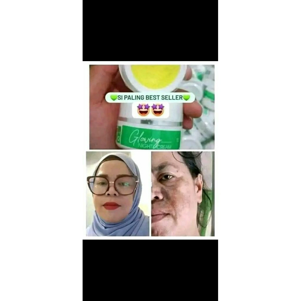 Cream flek maxie Glow kemasan lama.flek KB.n lainnya