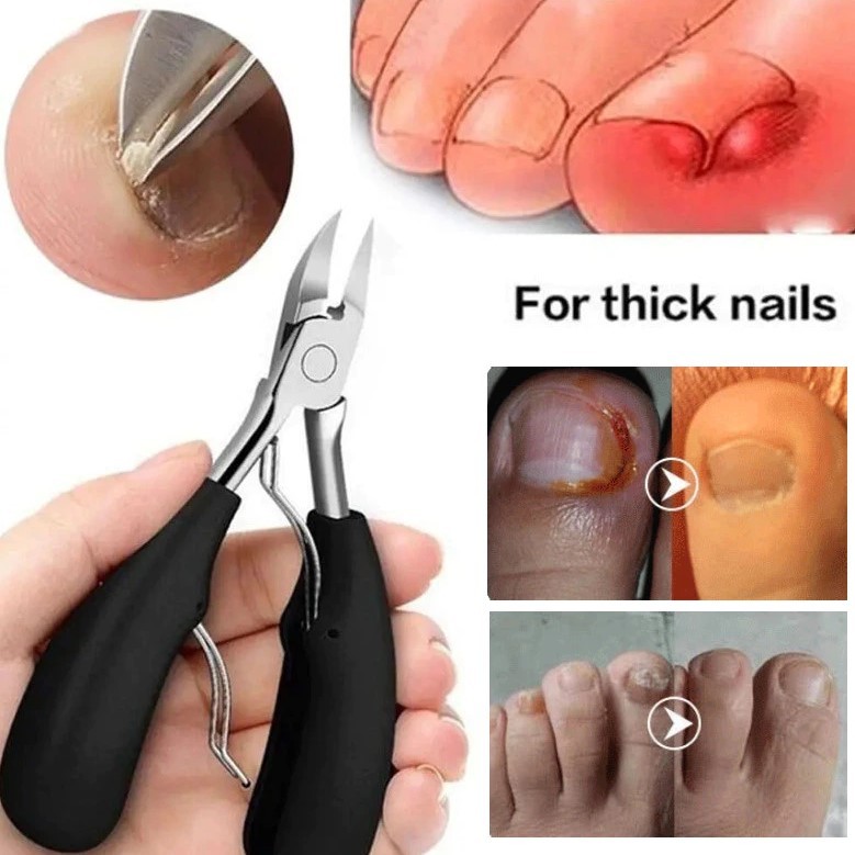 Gunting Kuku Kaki Jempol Anti Cantengan Pemotong Kuku Miring