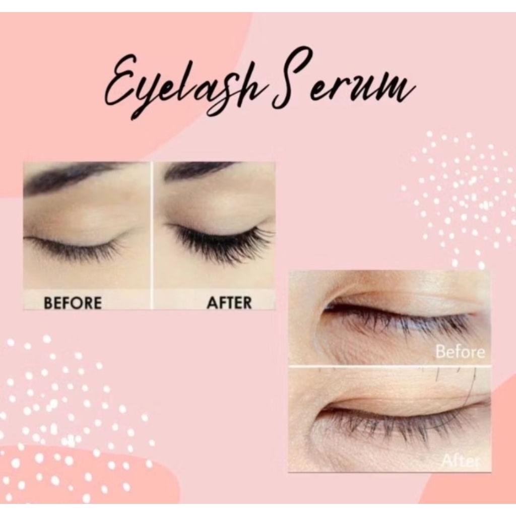 EYELASH SERUM PENUMBUH BULU MATA DAN HALIS BPOM AMAN HALAL SERUM BULU MATA DAN HALIS FREE APLIKATOR
