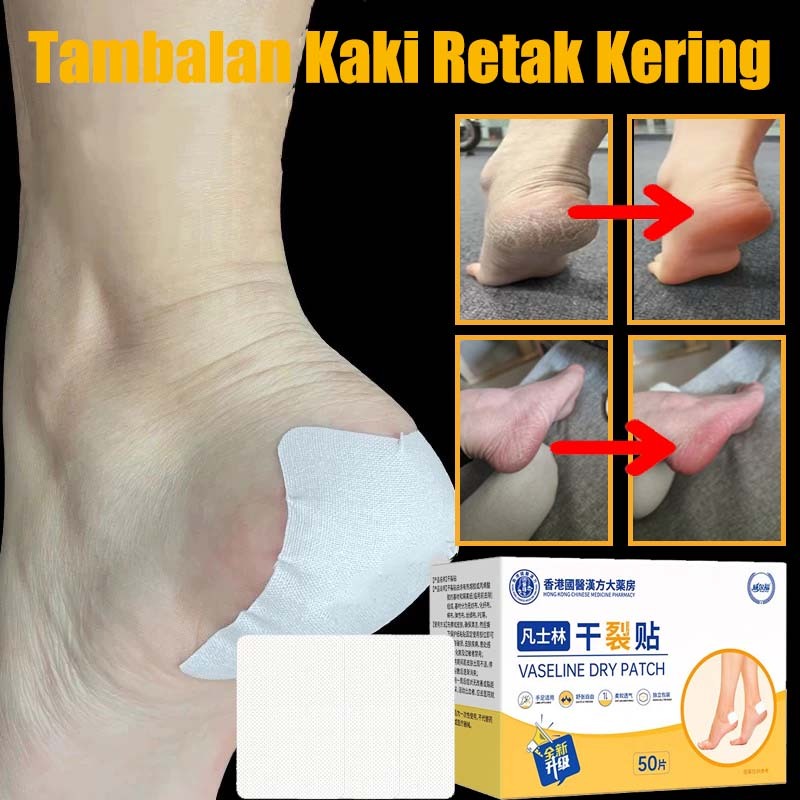 obat kaki pecah pecah penghilang kaki pecah dan kering salep kaki pecah2 paling ampuh pembersih kaki
