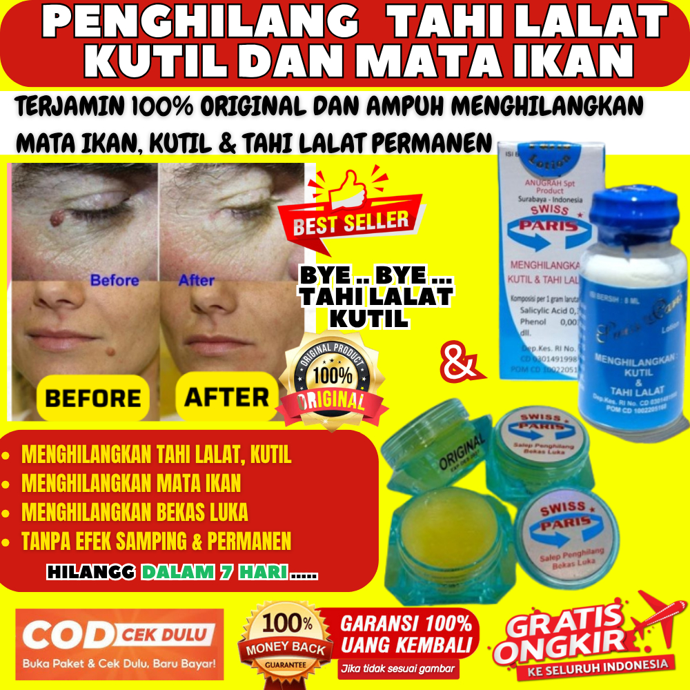 Swiss Swis Paris Lotion 100% Asli Original Obat Cream Krim Salep Penghilang Menghilangkan Tahi Tai L