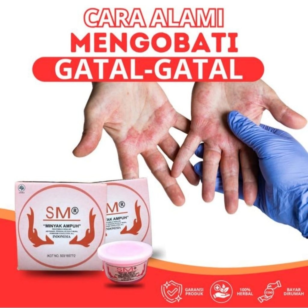sm salep minyak ampuh mengatasi masalah kulit