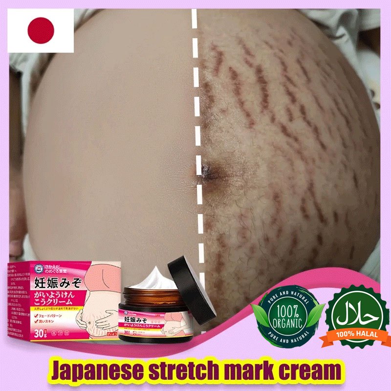 stretch mark cream/krim stretch mark ibu hamil 30g/cream stretch mark paling ampuh/penghilang stretc