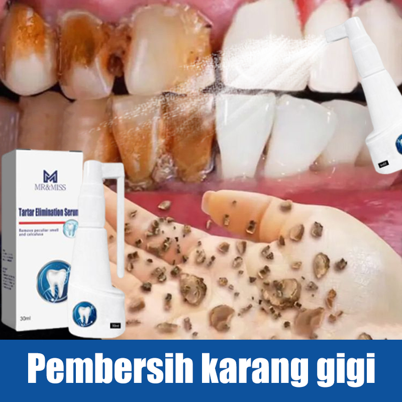 Pembersih gigi Pembersih karang gigi berkerak Penghilang karang gigi Perontok karang gigi 30ml Peron