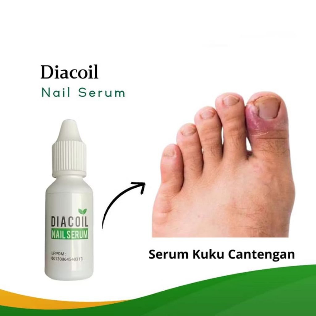 Diacoil Nail Serum Original 15ml Serum Penumbuh Kuku Rusak Cantengan Bernanah Kutikula Nail Art Pera
