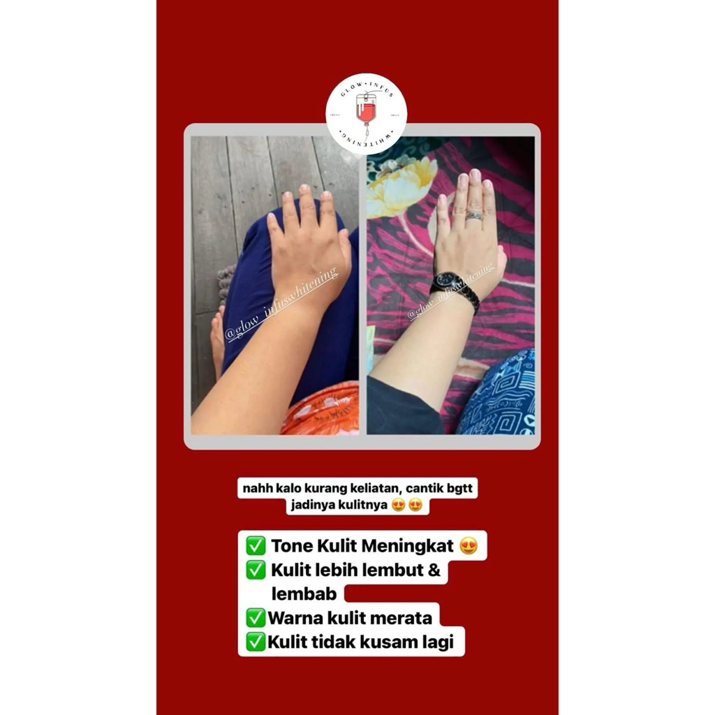 Sakura Glow| Infus Whitening | Memutihkan kulit |