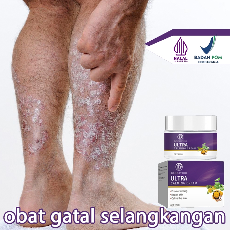 Salap gatal china obat gatal selangkangan dan hitam salep kulit 20g Salep selangkangan gatal dan lec