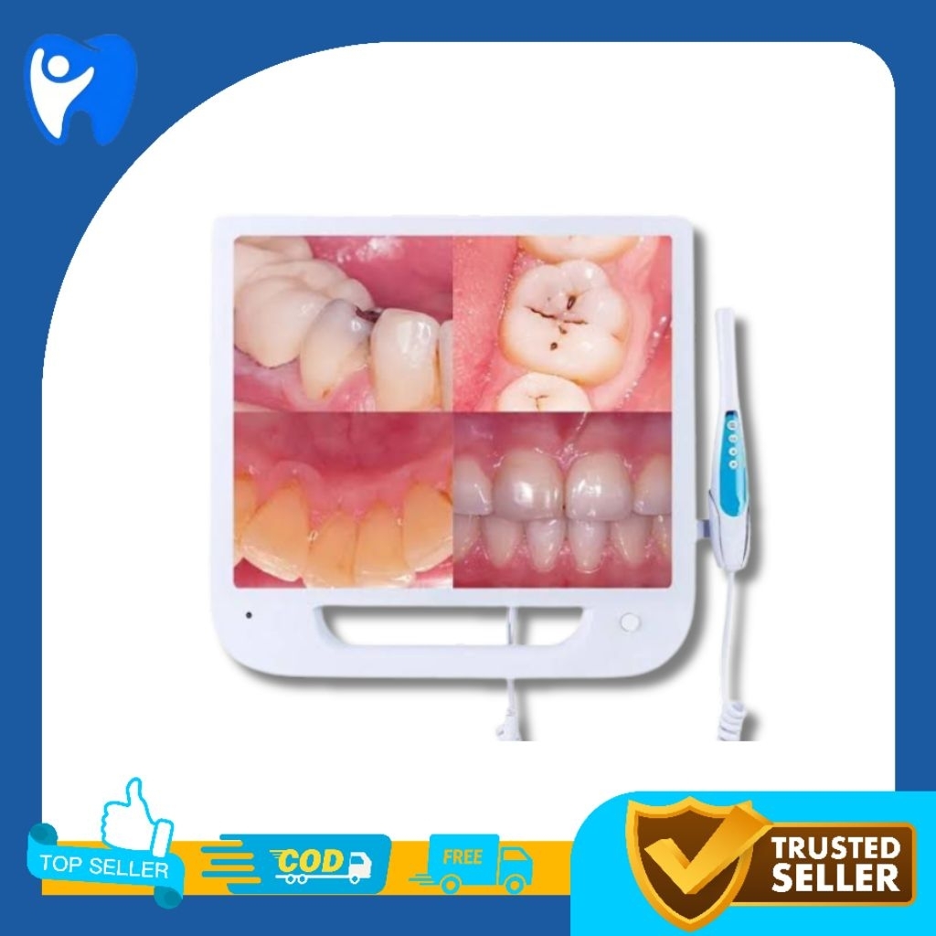 intra oral camera dental