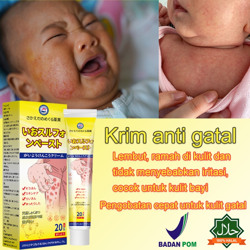 Salep gatal untuk bayi, salep eksim, salep gatal untuk dewasa 20g, salep gatal, salep gatal untuk se