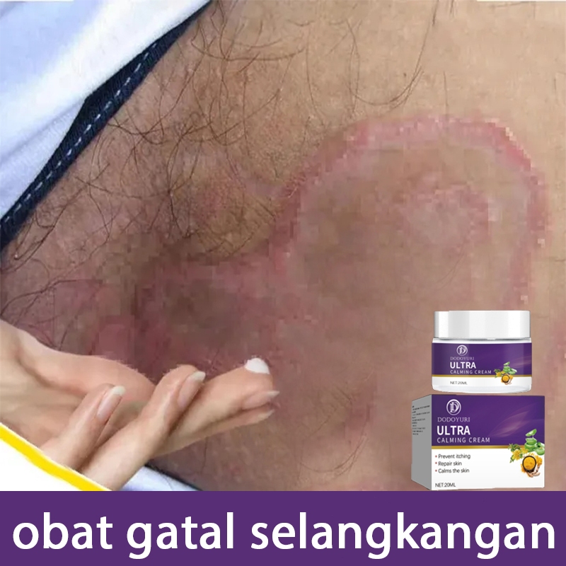 Salep china untuk gatal gatal obat gatal selangkangan dan hitam salep kulit 20g Salep selangkangan g