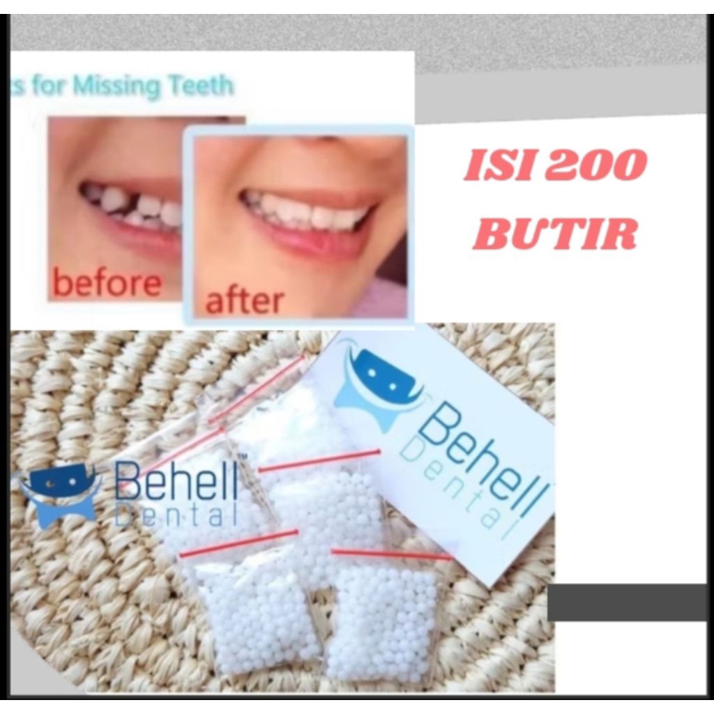 Temptooth Penambal Gigi Sementara -Temptooth Gigi Palsu Butiran - Temptooth Temporar...