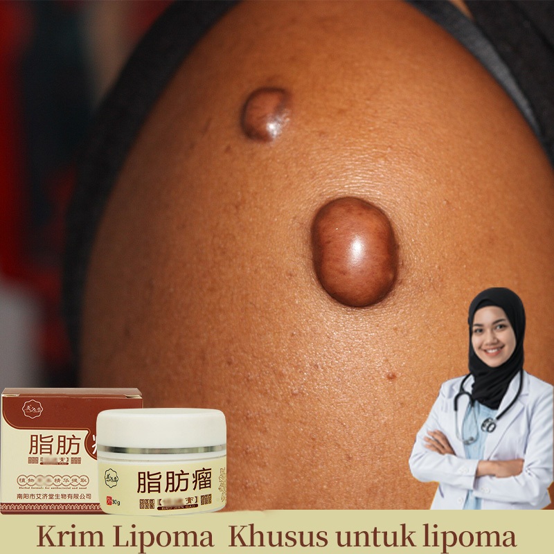 krim lipoma creamsalep benjolan 30g Obat Benjolan Lipoma Obat herbal Cina Tumor Kelenjar Tiroid Lipo