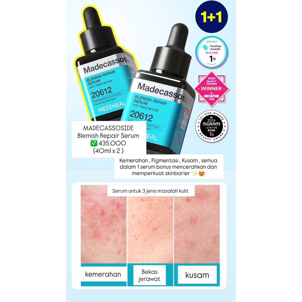 [READY&ORI🇰🇷] MEDIHEAL | Madecassoside Blemish Repair Serum