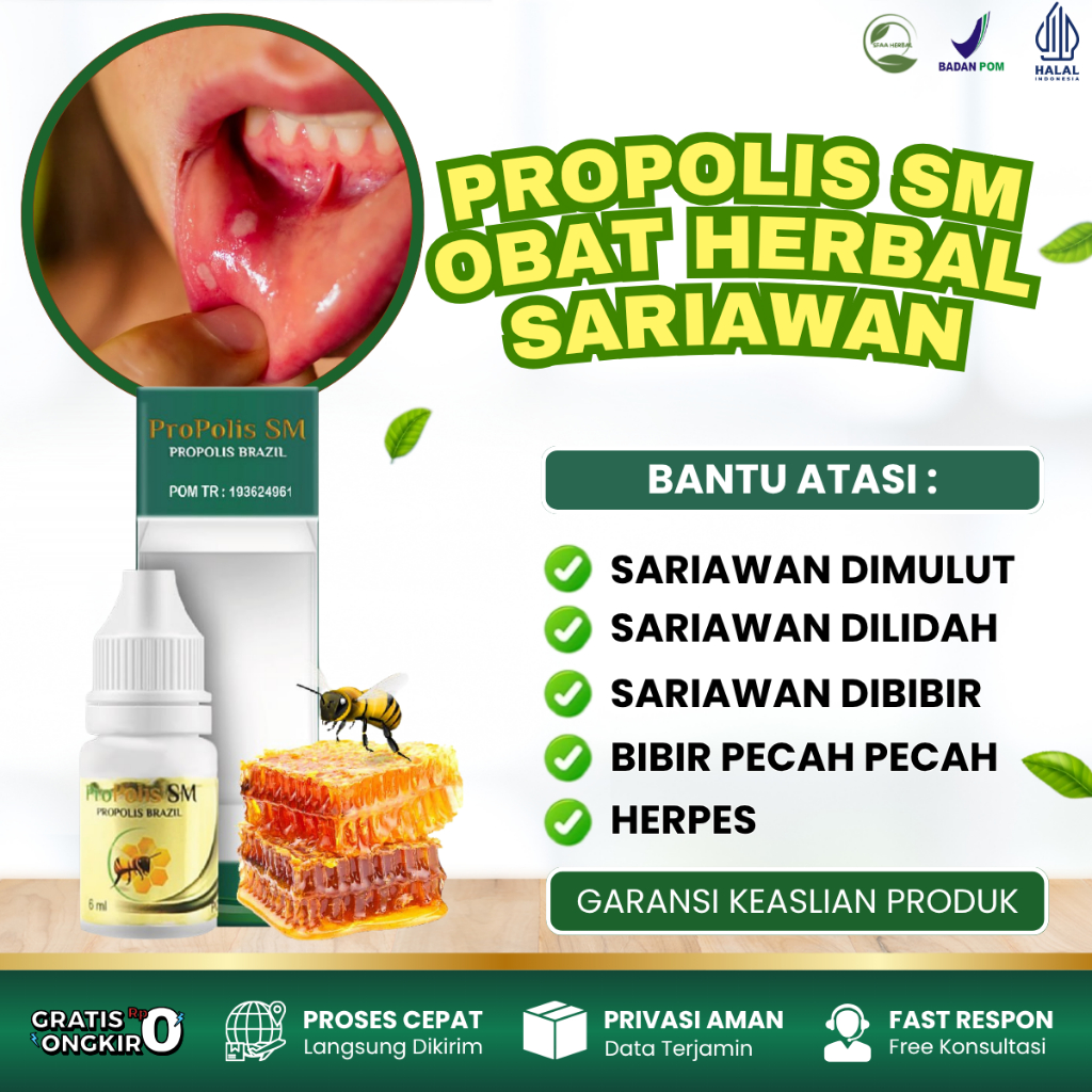 Propolis SM Obat Tetes Sariawan, Obat Sariawan Dimulut, Obat Sariawan Dilidah, Obat Sariawan Dibibir