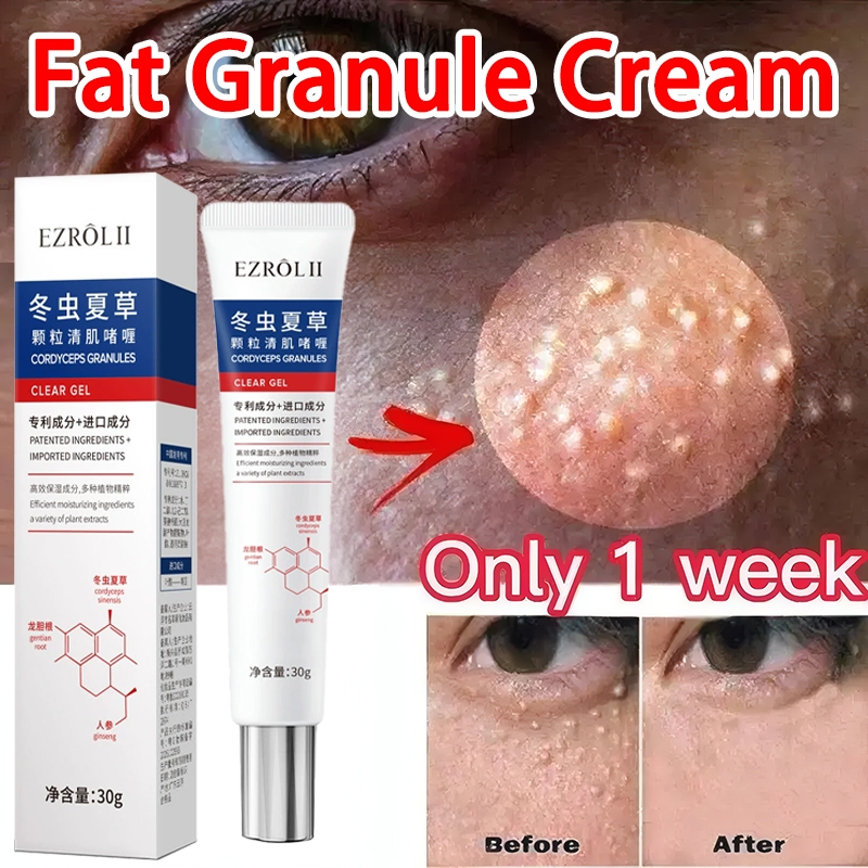 Pelembab tubuh melembabkan Krim mata Cordyceps Paling Ampuh Eye Krim Penghilang Milia Cream Milia Re