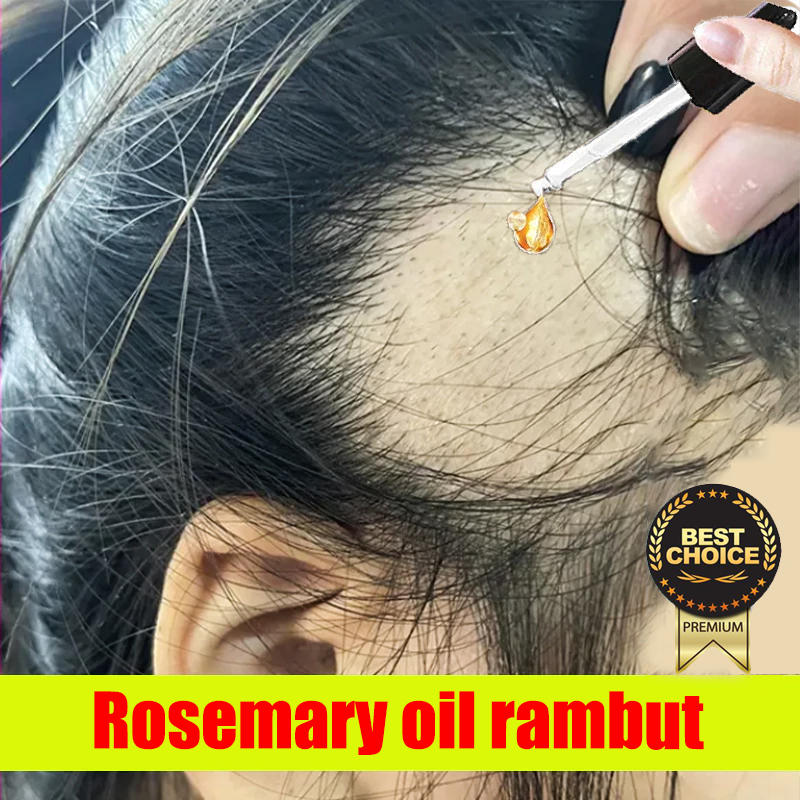 ORI Penumbuh Rambut Botak Alami | Minyak Rambut Rontok & Kebotakan Rambut penumbuh rambut botak Pene