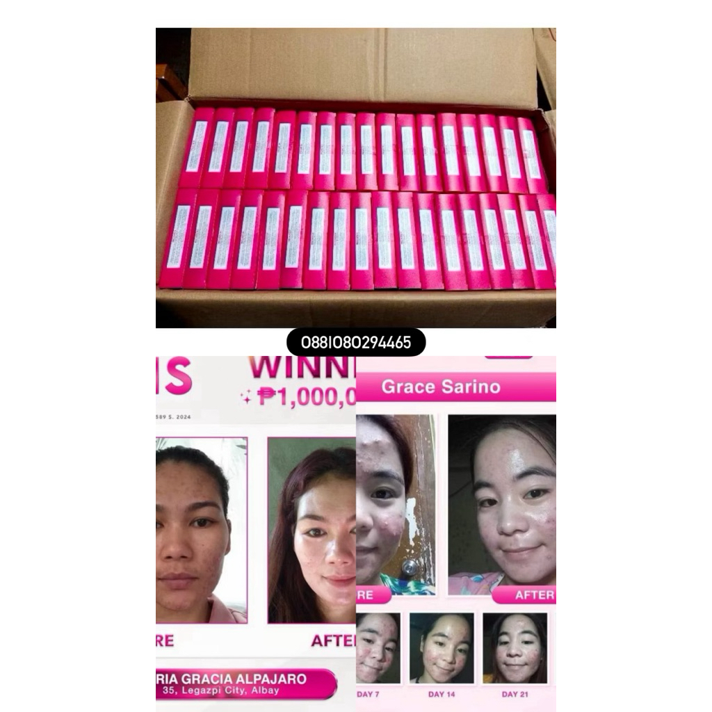 TERMURAH DI SHOPEE PAKET SEPAKET REJU SET ECER DAY NIGHT SUNSCREENS CREAM SIANG MALAM ISI ULANG REFI