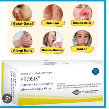 PROSIX | OBAT GATAL | OBAT ALERGI DEBU | OBAT ALERGI KULIT | OBAT ALERGI FLU
