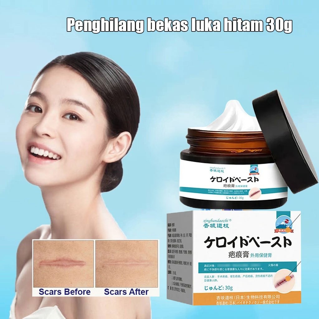 Krim Penghilang Bekas Luka Jahitan Luka Bedah Hiperplasia Krim Keloid