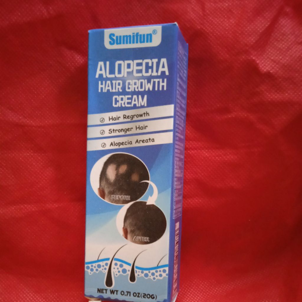 READY STOCK] Obat Alopecia Areata, penumbuh rambut cepat Obat, penumbuh rambut