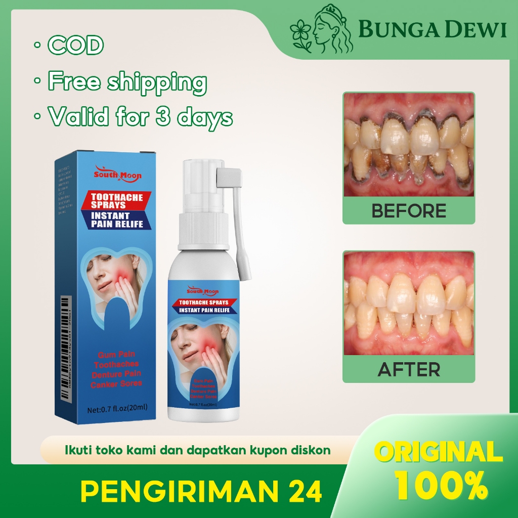 【Beli 3 Gratis 2/COD/ORI】South Moon Obat Sakit Gigi Berlubang Toothache Spray 20ml Obat Sakit Gigi O