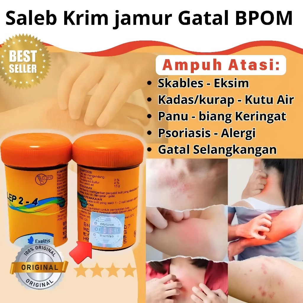 Cod Salep Gatal Zwafel 24 Original Asli Obat Salep Gatal Panu Kadas Kurap Kutu Air Original