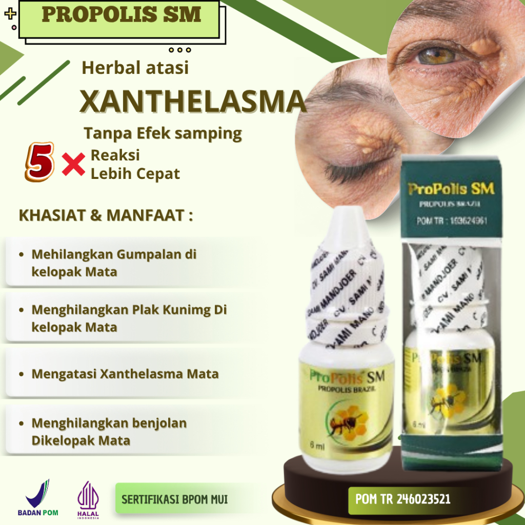 Obat Tetes Cair Penghilang Plak Kuning Dekat Mata Xanthelasma Kutil Milia Bintik Putih di Kelopak Ma