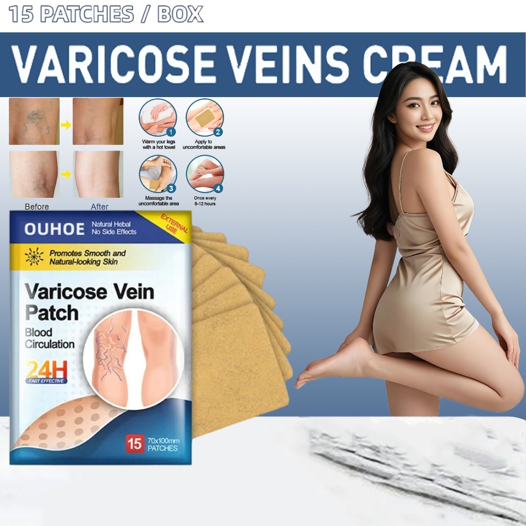 OUHOE Koyo Varises Penghilang Varises Di Kaki Varicose Patch Obat Varises Herbal Koyo Varicose 15pcs