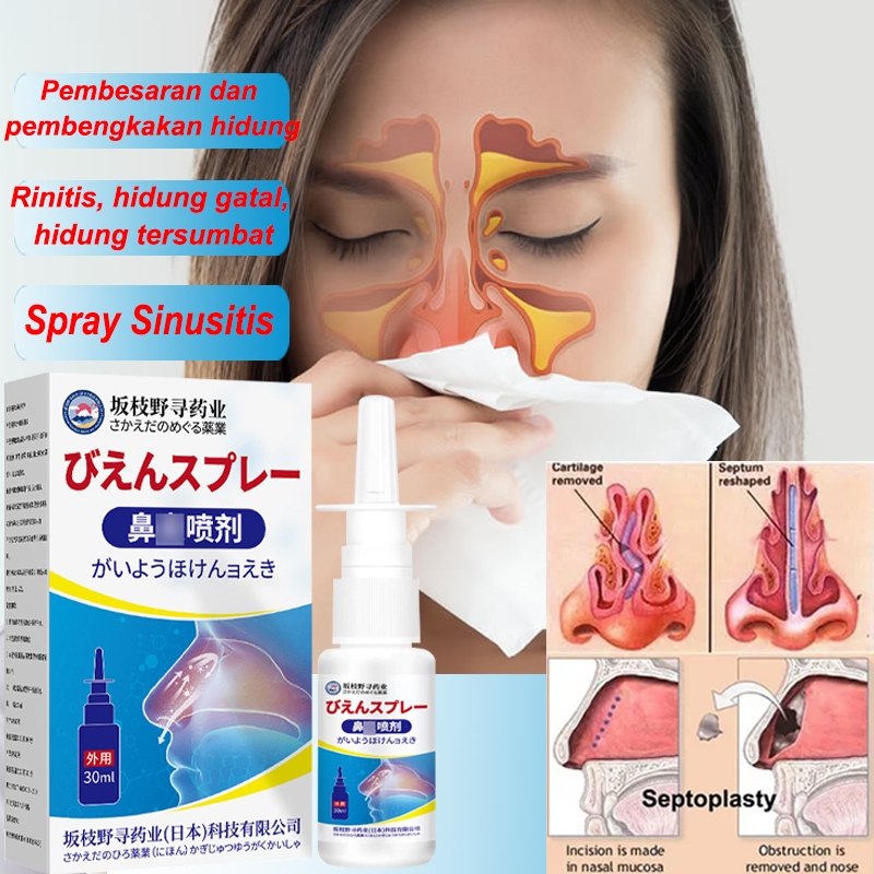 Semprotan hidung, semprotan sinusitis, obat antivirus obat sinusitis, obat hidung tersumbat, semprot