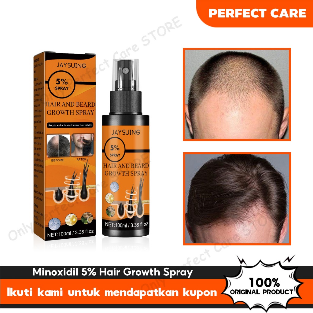 Jaysuing Minoxidil 5% Penumbuh Rambut 100ml Penumbuh Dan Penebal Cepat Serum Penumbuh Rambut Beard O