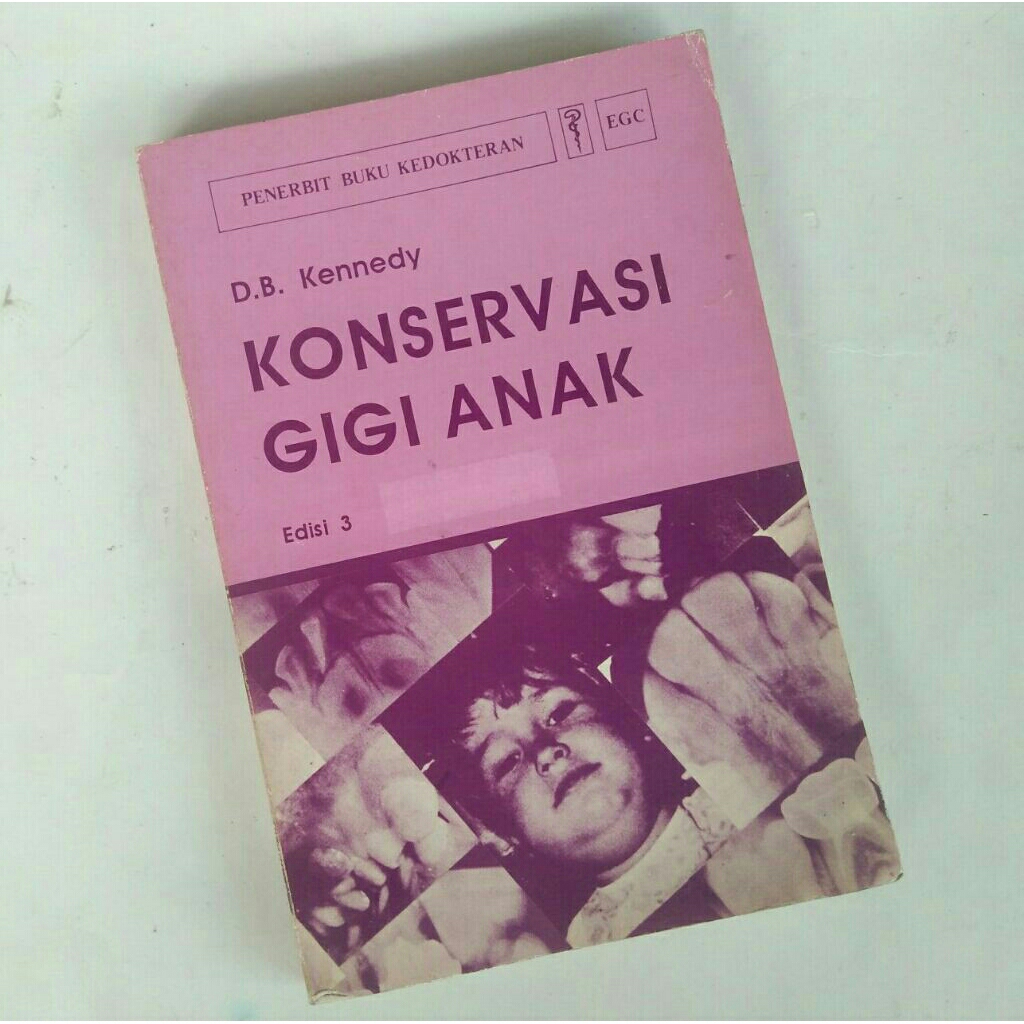 Buku Kedokteran < Konservasi Gigi Anak Edisi 3 < D. B. Kennedy < EGC, 1992.(bekas,  original)