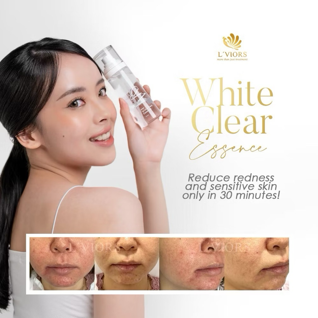 LViors White Clear Essence 100ML Exp 07-09-2028 Free Papermask WCE