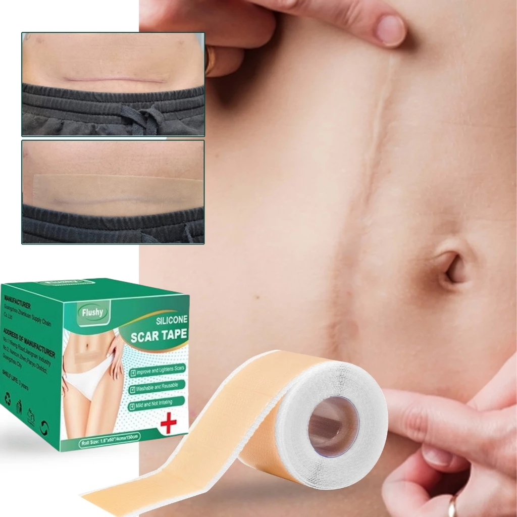 Silicone Keloid Keloplast Silicone Keloid Plester Scar Tape Keloid Bekas Luka Silicone Scar Sheet pl
