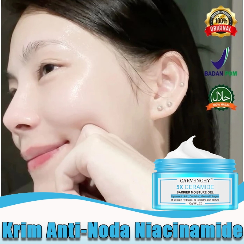 Krim Pemutih Anti Flek 30g, Cream Flek Hitam Bandel, Krim Bintik Niacinamide, Krim Bintik Pemutih, K