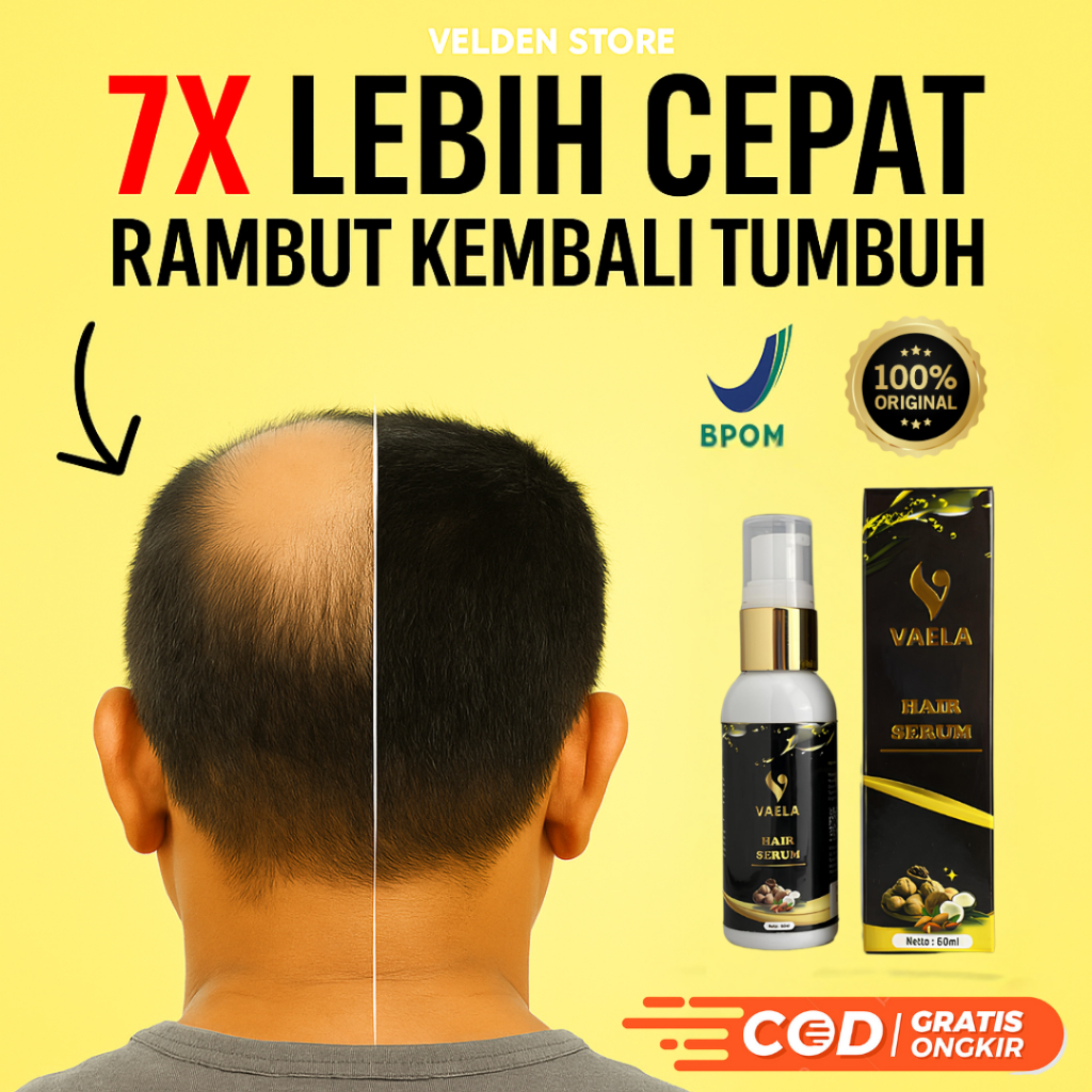 VAELA Hair Serum Penumbuh & Penyubur Rambut | Atasi Kebotakan, Rambut Rontok & Tipis | BPOM Original